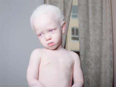 albino feio|Albino Feio Feio